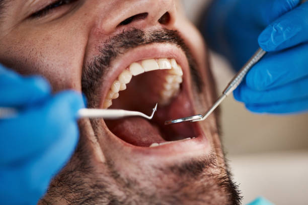 Best Emergency Dentist for Lost Fillings or Crowns in Point Baker, FL