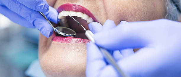 Best Emergency Dental Extractions in Point Baker, FL
